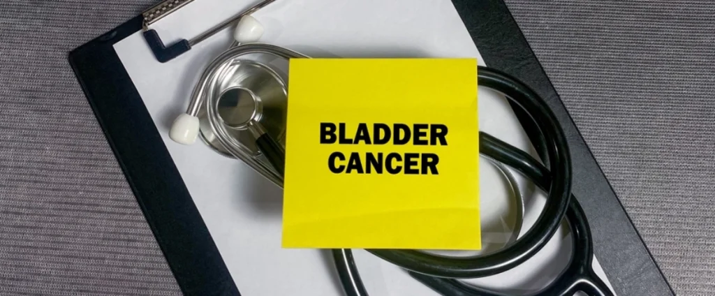 Understanding and Treating Bladder Cancer